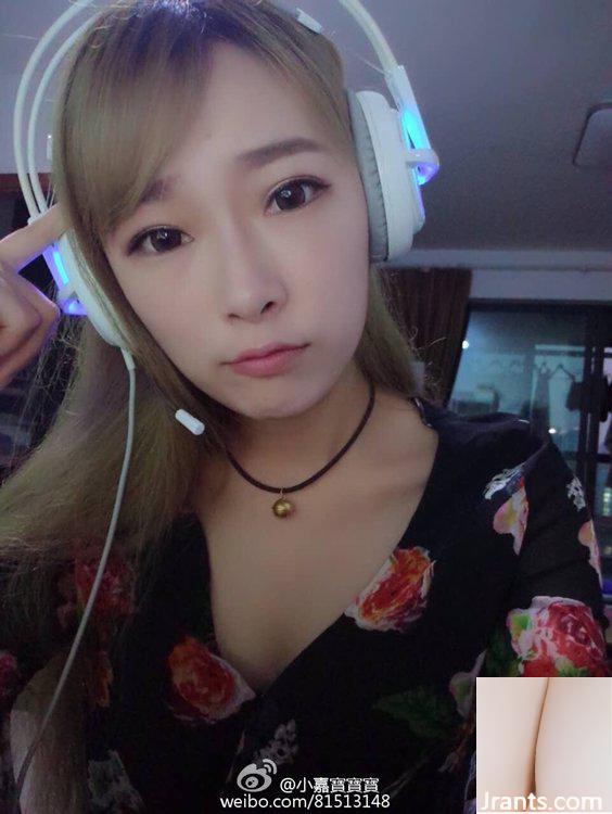 “Nếu yêu cô ấy thì xin đừng bắt nạt cô ấy.” Người mẫu trẻ gợi cảm Xiao Jiabao bị trói đến bầm tím (16P) - Ảnh 5